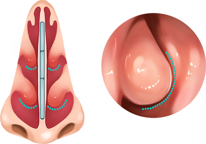 코 내부 일러스트 이미지